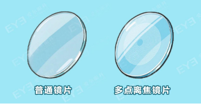 咳！家长坚信 &ldquo;一戴镜就摘不下来&rdquo;，9 岁娃近视半年度数翻倍1304