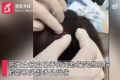 女子被养2年猫攻击致颅部3级损伤 打了6针狂犬疫苗