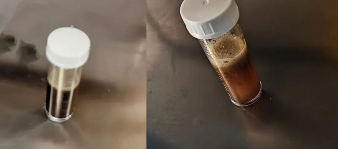 肺部吸出的误吸物.jpg