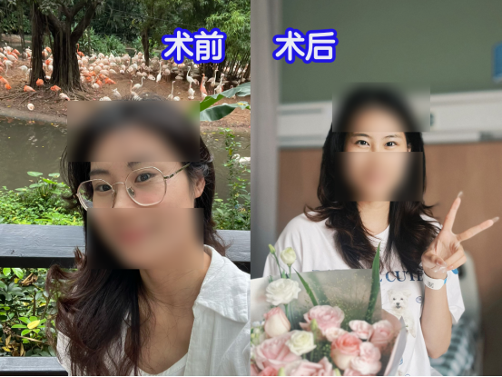 告别日抛月抛、红血丝！高度近视宝妈植入&ldquo;143