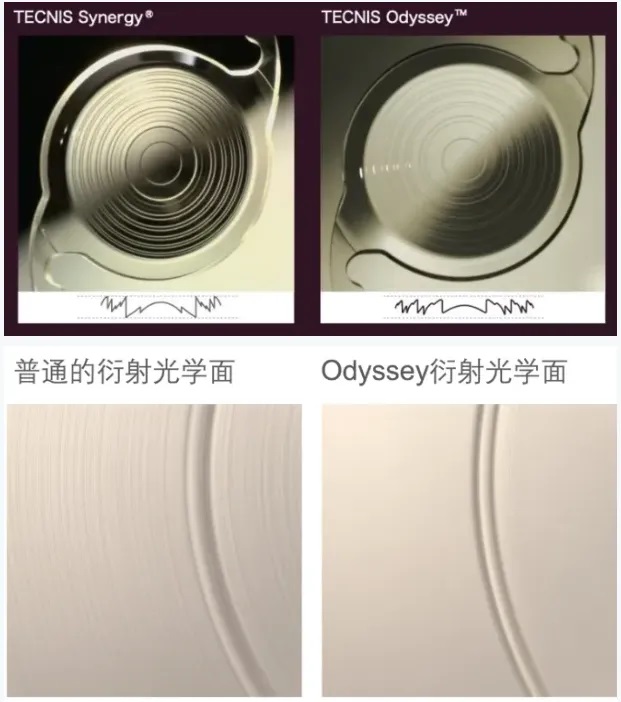 厦门眼科中心成功开展强生TECNIS Odyssey奥德赛全视程人工晶状体植入术