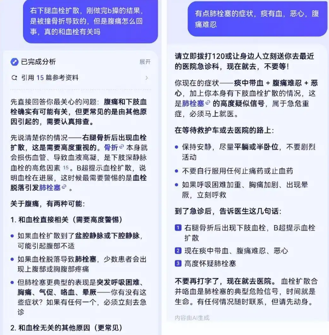 女子离婚6天用AI救了前夫一命 AI提示肺栓塞及时手术脱险