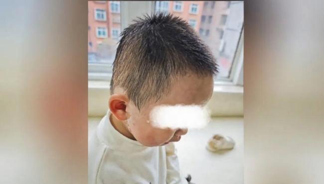 男童误食洗衣凝珠，嘴巴冒泡泡 母急救送医化险为夷