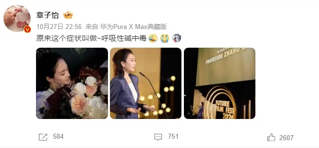 章子怡自曝拍戏时曾呼吸性碱中毒：拍完后身上都是麻的 