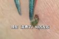 女子被蜱虫咬伤住ICU28天四肢瘫痪 确诊森林脑炎医疗费已花40万元